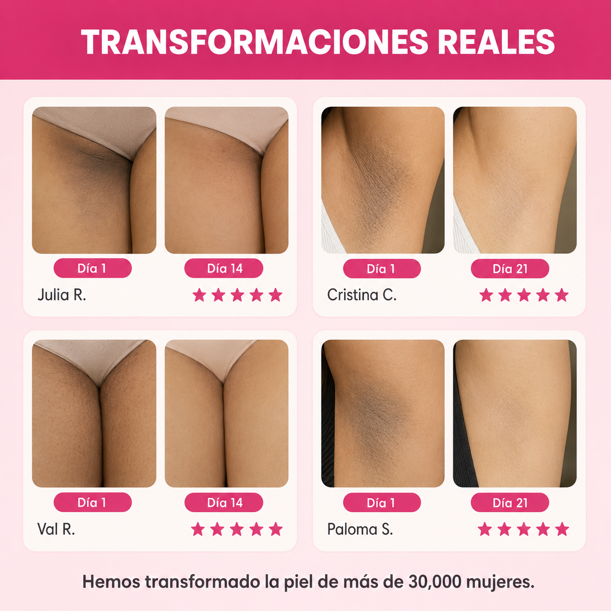 Crema Aclarante SkinGlow